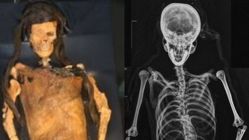 Auna y Fundación Wiese presentan avances en el análisis radiológico de la Señora de Cao en Congreso Internacional de Radiología