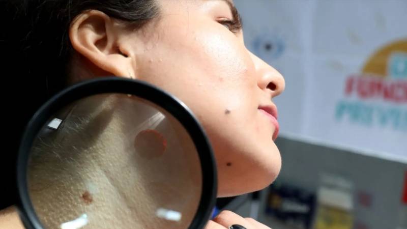 cáncer de piel campaña