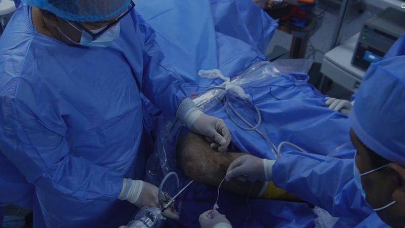 trasplante de meniscos