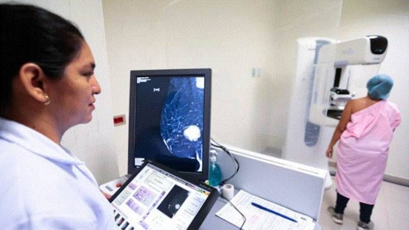 Cáncer de mama