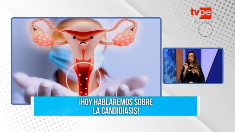 Candidiasis en mujeres