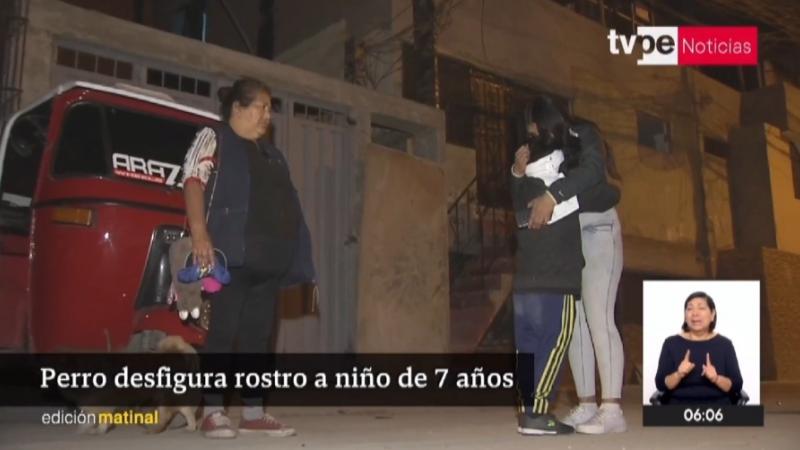 Villa El Salvador perro niño desfigurado
