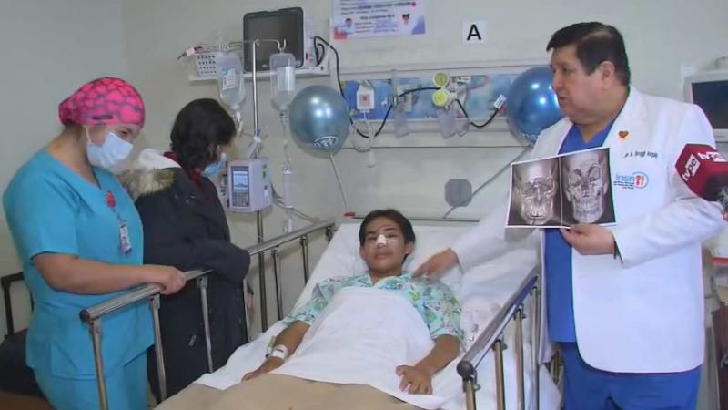 Hospital del Niño San Borja: se realizó primera cirugía de reconstrucción facial