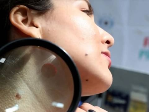 cáncer de piel campaña