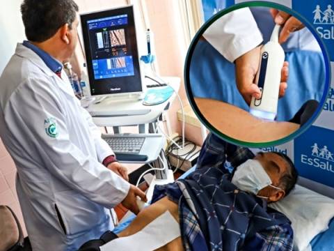 Essalud médico medicina portada salud hepática hígado