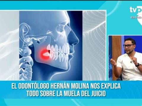 Muela del juicio