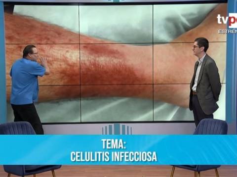 Celulitis