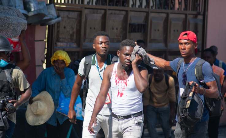 Periodista herido en Haití